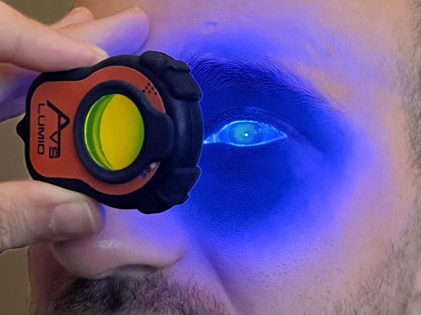 AVS Lumio Portable Anterior Eye Inspector